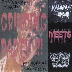 Malignant Tumour : Grinding Party !!!